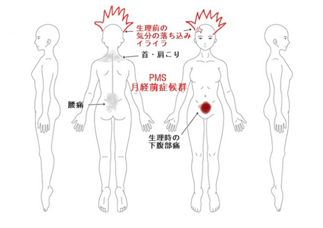 婦人科疾患改善の症例報告 症例1 月経前症候群 月経前緊張症 Pms 大阪市 鍼灸院 漢方鍼灸院 大阪市てんま吉祥堂