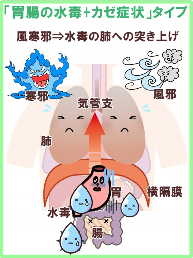 漢方医学からみた ３つの花粉症 慢性鼻炎体質とは 大阪市 鍼灸院 漢方鍼灸院 大阪市てんま吉祥堂